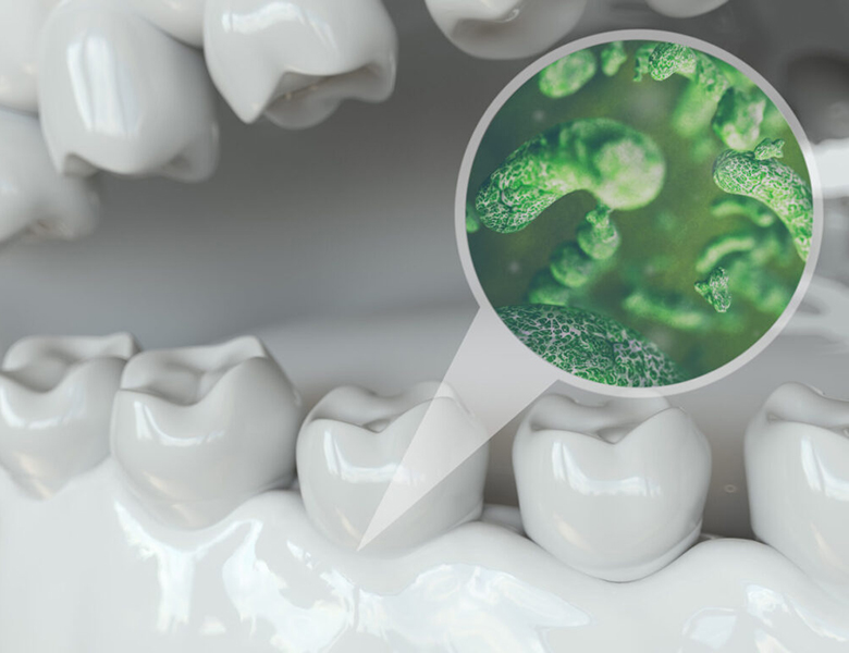 外苑前（東京）の歯医者、Angel総合歯科でブルーラジカル治療