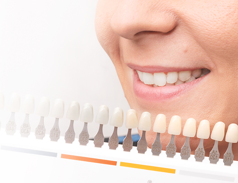 外苑前（東京）の歯医者、Angel総合歯科でホワイトニング