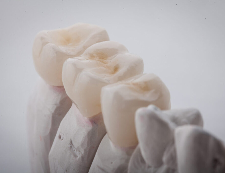 外苑前（東京）の歯医者、Angel総合歯科の自費専門の強み