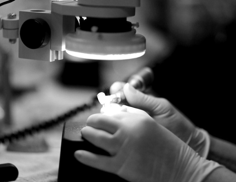 外苑前（東京）の歯医者、Angel総合歯科でマイクロスコープ精密治療