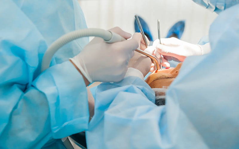 蒲田のインプラント専門医院、のびのび歯科・矯正歯科